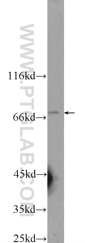 Western Blot (WB) analysis of L02 cells using MMP21 Polyclonal antibody (55289-1-AP)
