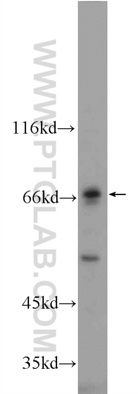 Western Blot (WB) analysis of mouse liver tissue using MMP21 Polyclonal antibody (55289-1-AP)