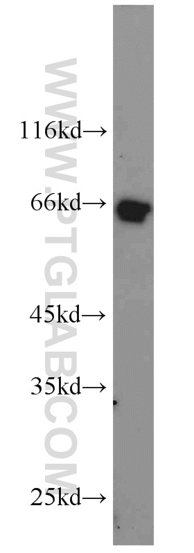 Western Blot (WB) analysis of PC-3 cells using MMP23B Polyclonal antibody (13020-1-AP)