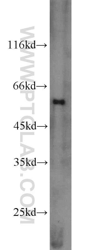 Western Blot (WB) analysis of HepG2 cells using MMP23B Polyclonal antibody (13020-1-AP)