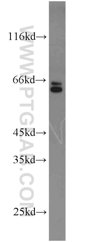 Western Blot (WB) analysis of A549 cells using MMP23B Polyclonal antibody (13020-1-AP)