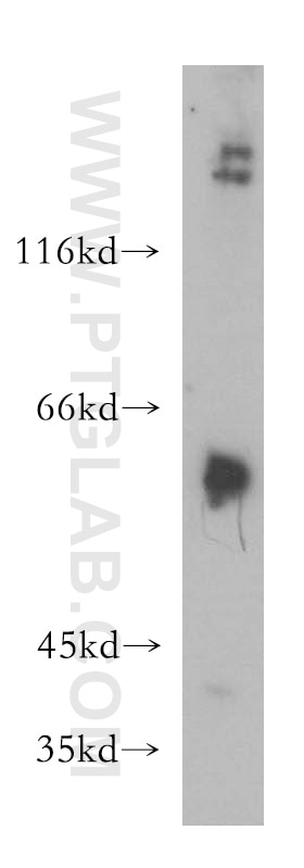 Western Blot (WB) analysis of HepG2 cells using MMP23B Polyclonal antibody (13020-1-AP)
