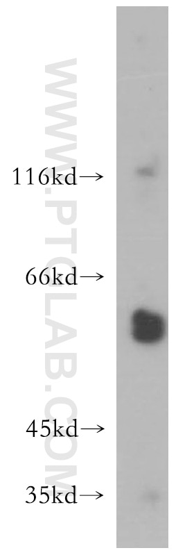 Western Blot (WB) analysis of A549 cells using MMP23B Polyclonal antibody (13020-1-AP)