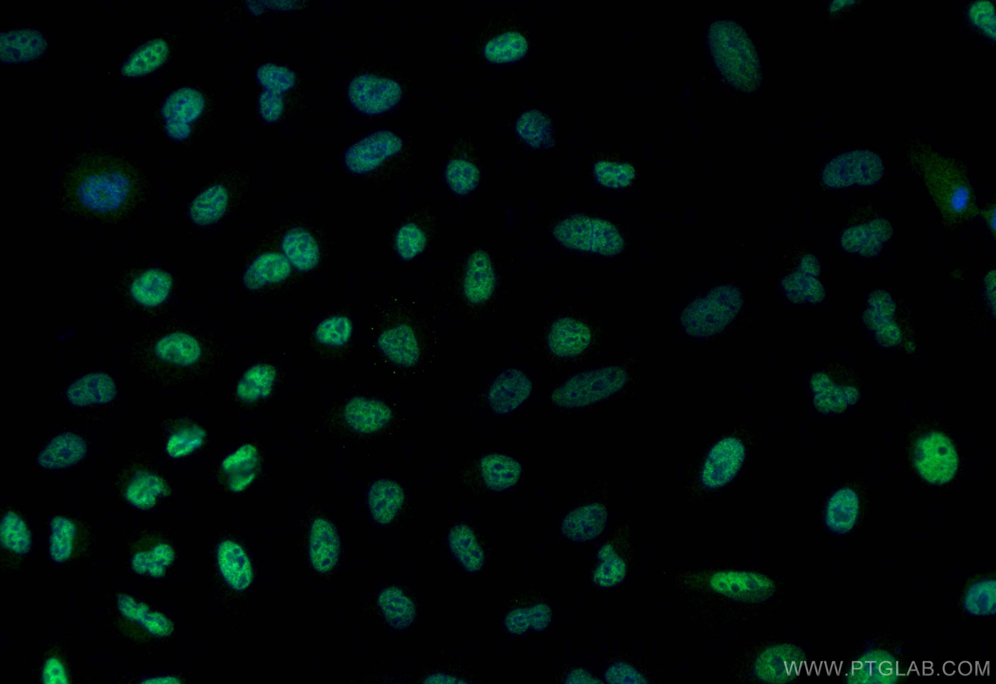 Immunofluorescence (IF) / fluorescent staining of A549 cells using MMP25 Polyclonal antibody (30655-1-AP)