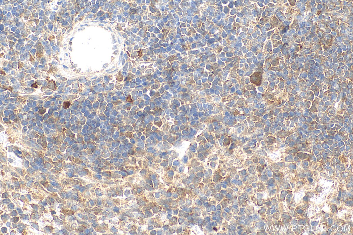 Immunohistochemistry (IHC) staining of mouse spleen tissue using MMP25 Polyclonal antibody (30655-1-AP)