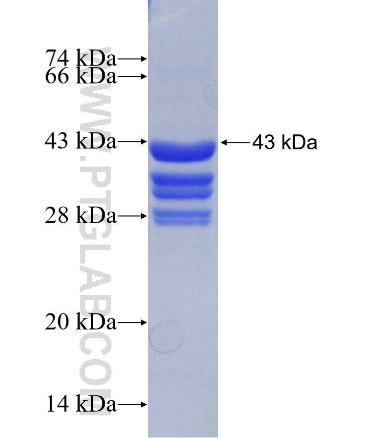 MMP25 fusion protein Ag29304 SDS-PAGE