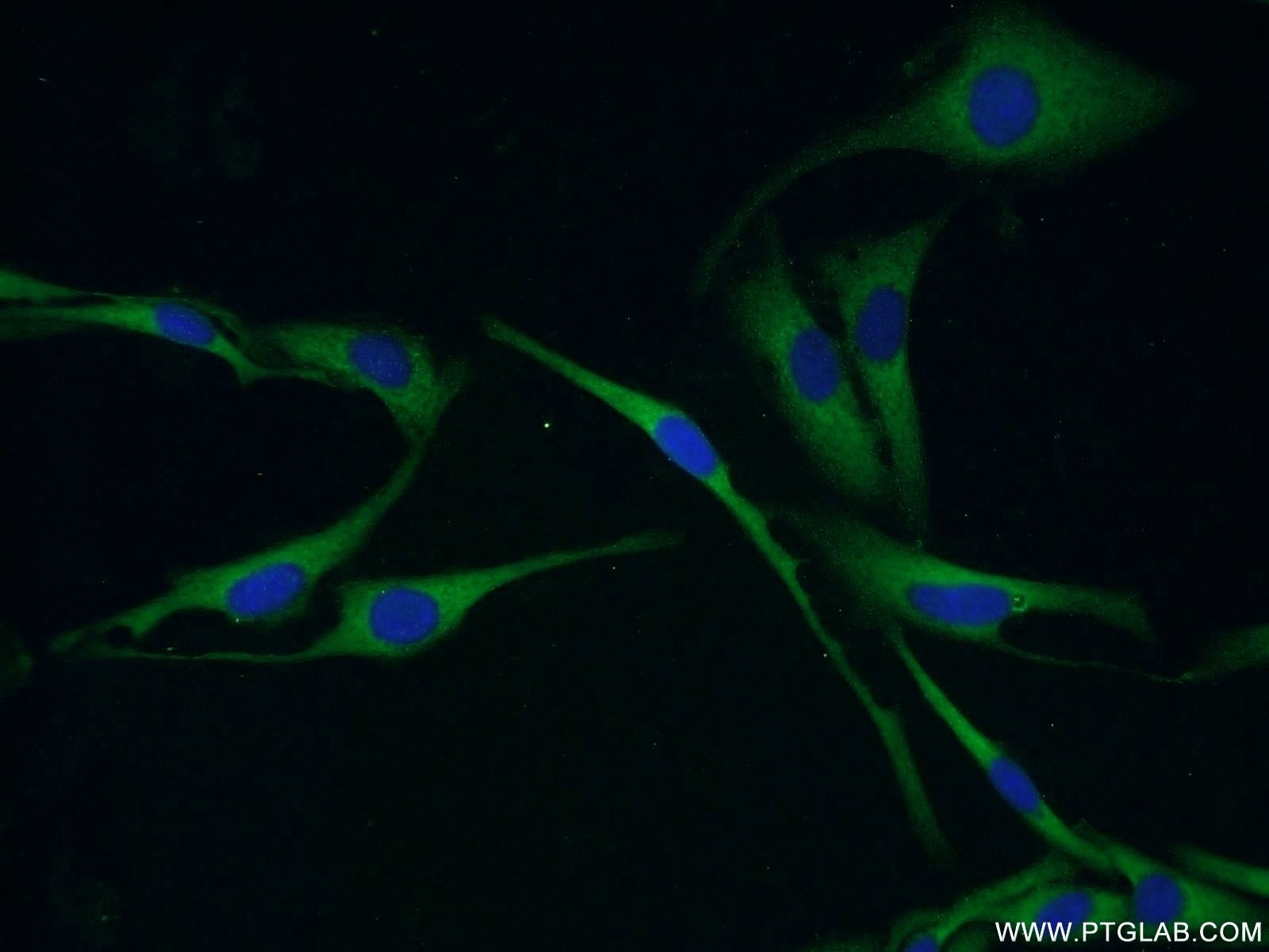 Immunofluorescence (IF) / fluorescent staining of SKOV-3 cells using MMP26 Polyclonal antibody (18087-1-AP)