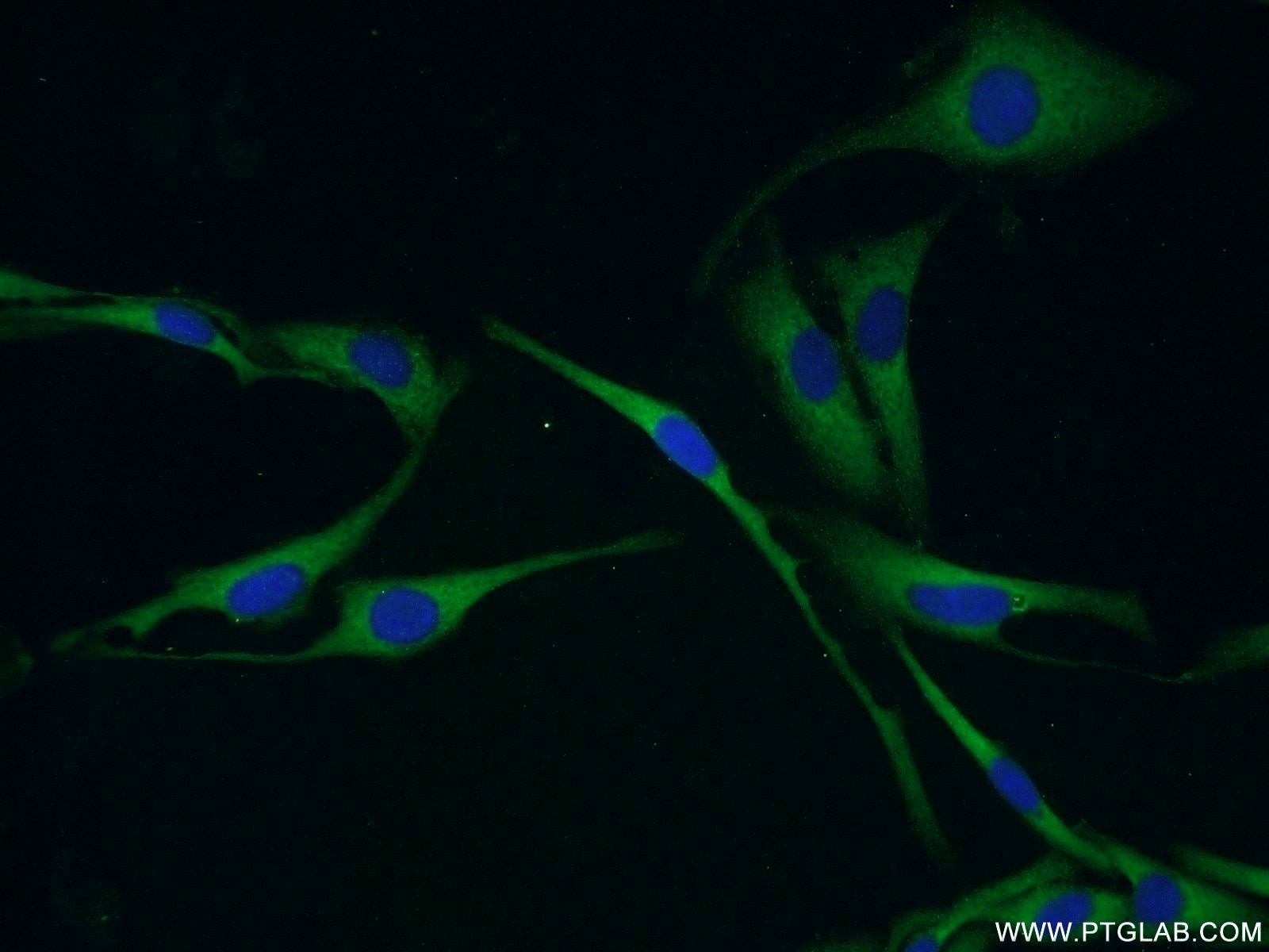 IF Staining of SKOV-3 using 18087-1-AP