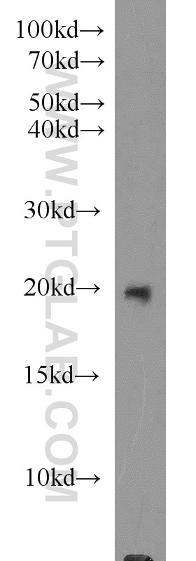 Western Blot (WB) analysis of SKOV-3 cells using MMP26 Polyclonal antibody (18087-1-AP)