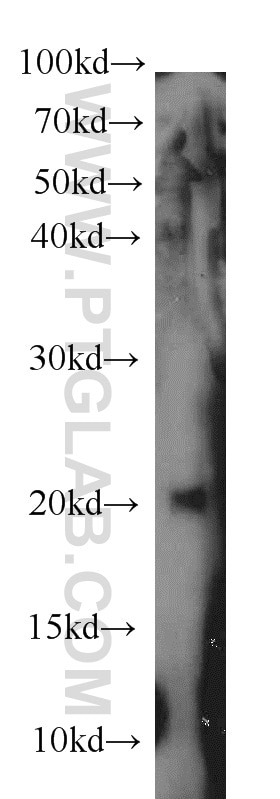 Western Blot (WB) analysis of human placenta tissue using MMP26 Polyclonal antibody (18087-1-AP)