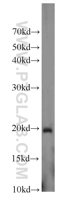 Western Blot (WB) analysis of HEK-293 cells using MMP26 Polyclonal antibody (18087-1-AP)
