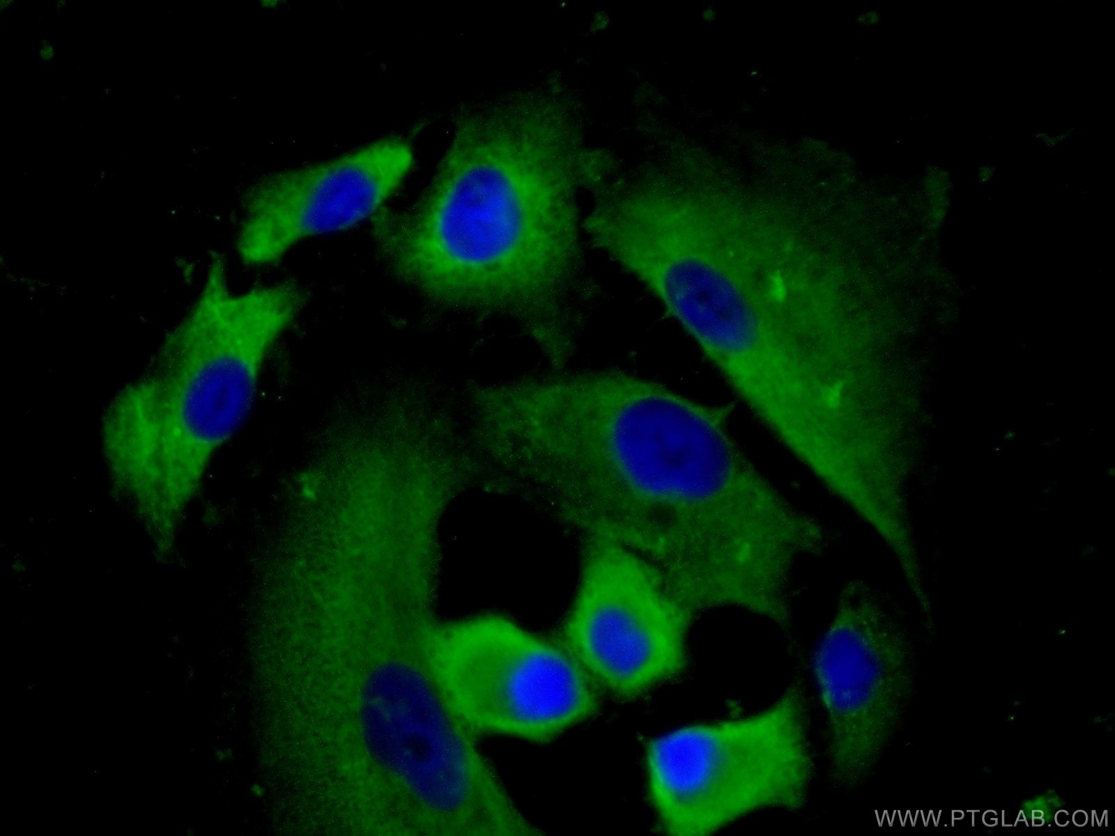 Immunofluorescence (IF) / fluorescent staining of A549 cells using MMP28 Polyclonal antibody (18237-1-AP)