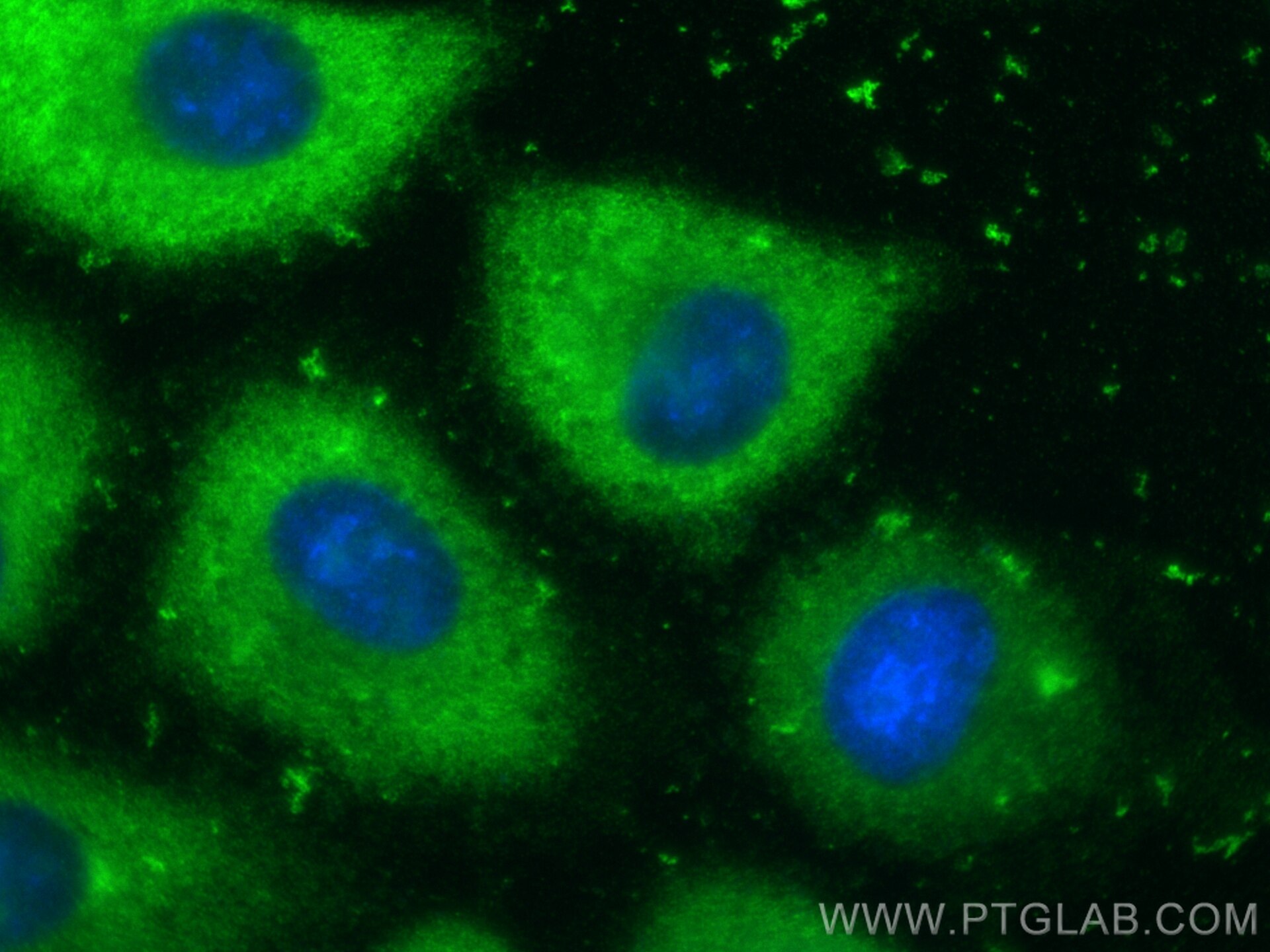 Immunofluorescence (IF) / fluorescent staining of A549 cells using MMP28 Polyclonal antibody (18237-1-AP)