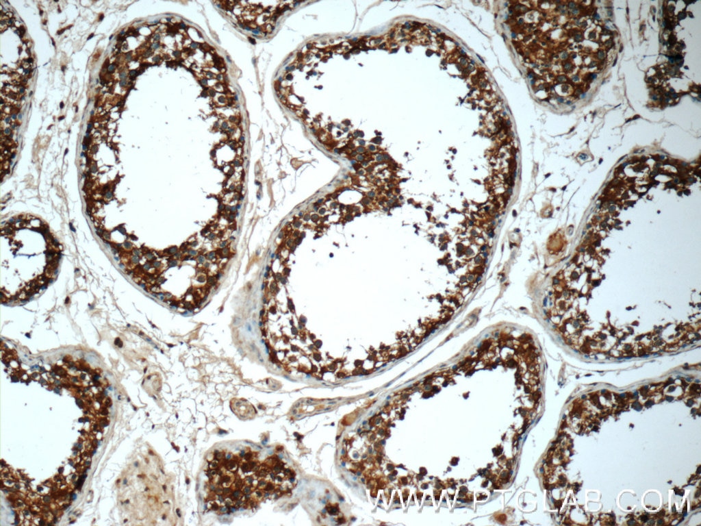 Immunohistochemistry (IHC) staining of human testis tissue using MMP28 Polyclonal antibody (18237-1-AP)