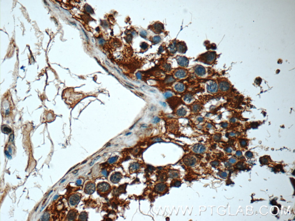 Immunohistochemistry (IHC) staining of human testis tissue using MMP28 Polyclonal antibody (18237-1-AP)