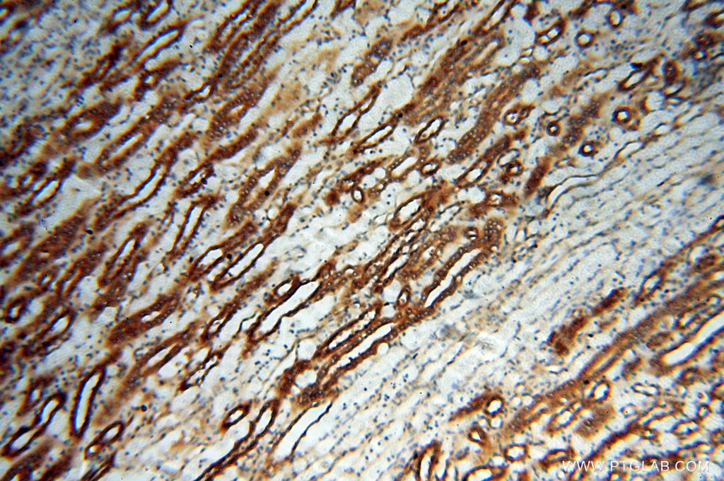 Immunohistochemistry (IHC) staining of human kidney tissue using MMP28 Polyclonal antibody (18237-1-AP)