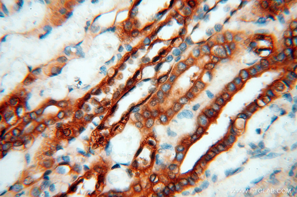 Immunohistochemistry (IHC) staining of human kidney tissue using MMP28 Polyclonal antibody (18237-1-AP)