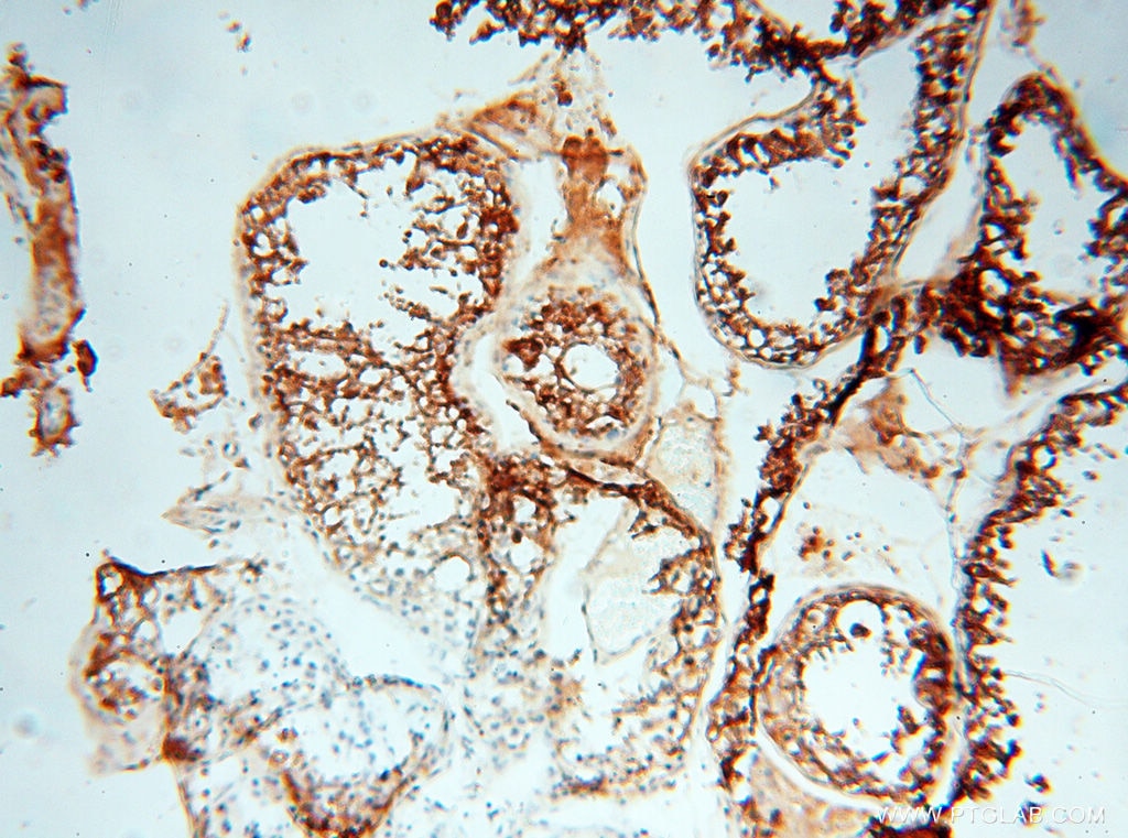 IHC staining of human testis using 18237-1-AP