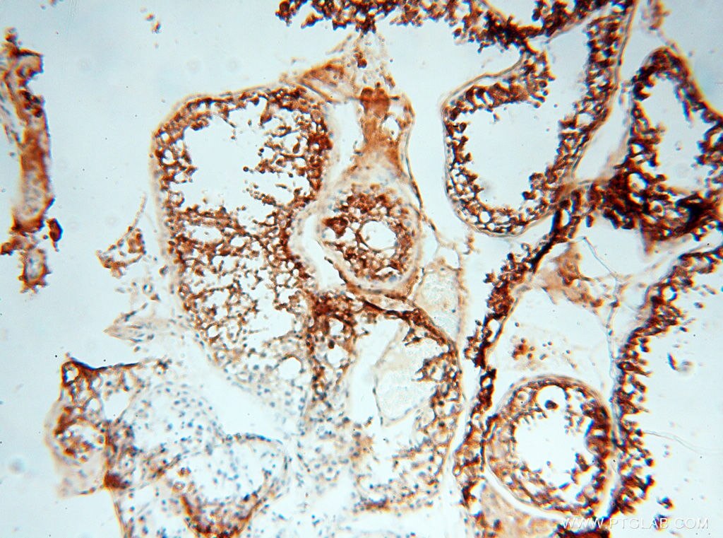 Immunohistochemistry (IHC) staining of human testis tissue using MMP28 Polyclonal antibody (18237-1-AP)