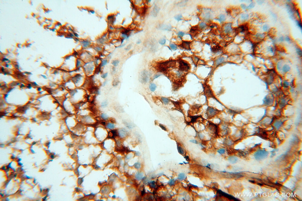 Immunohistochemistry (IHC) staining of human testis tissue using MMP28 Polyclonal antibody (18237-1-AP)