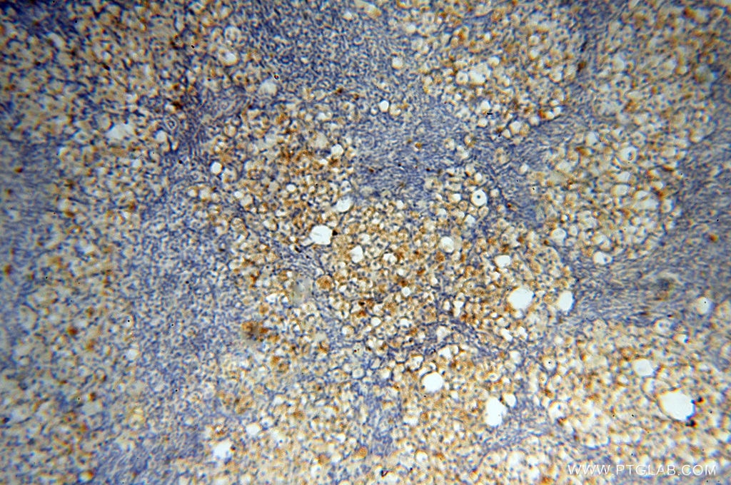 Immunohistochemistry (IHC) staining of human ovary tissue using MMP28 Polyclonal antibody (18237-1-AP)