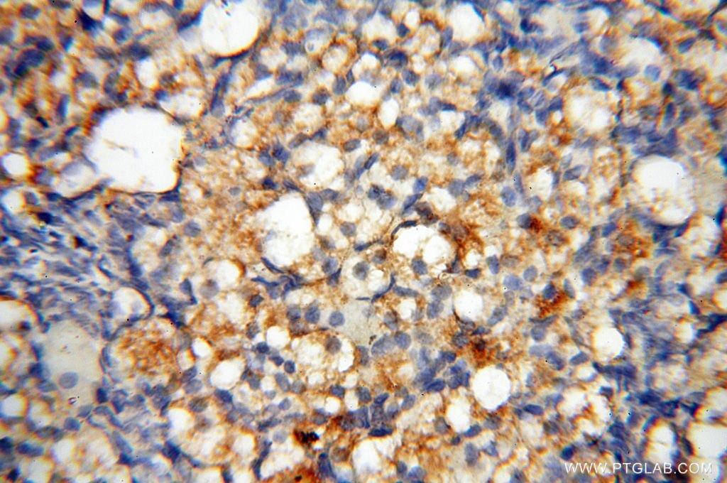 Immunohistochemistry (IHC) staining of human ovary tissue using MMP28 Polyclonal antibody (18237-1-AP)