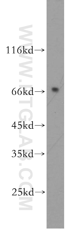 Western Blot (WB) analysis of human colon tissue using MMP28 Polyclonal antibody (18237-1-AP)