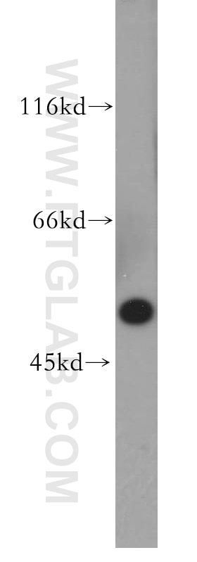 Western Blot (WB) analysis of A549 cells using MMP28 Polyclonal antibody (18237-1-AP)