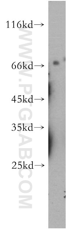 Western Blot (WB) analysis of mouse heart tissue using MMP28 Polyclonal antibody (18237-1-AP)