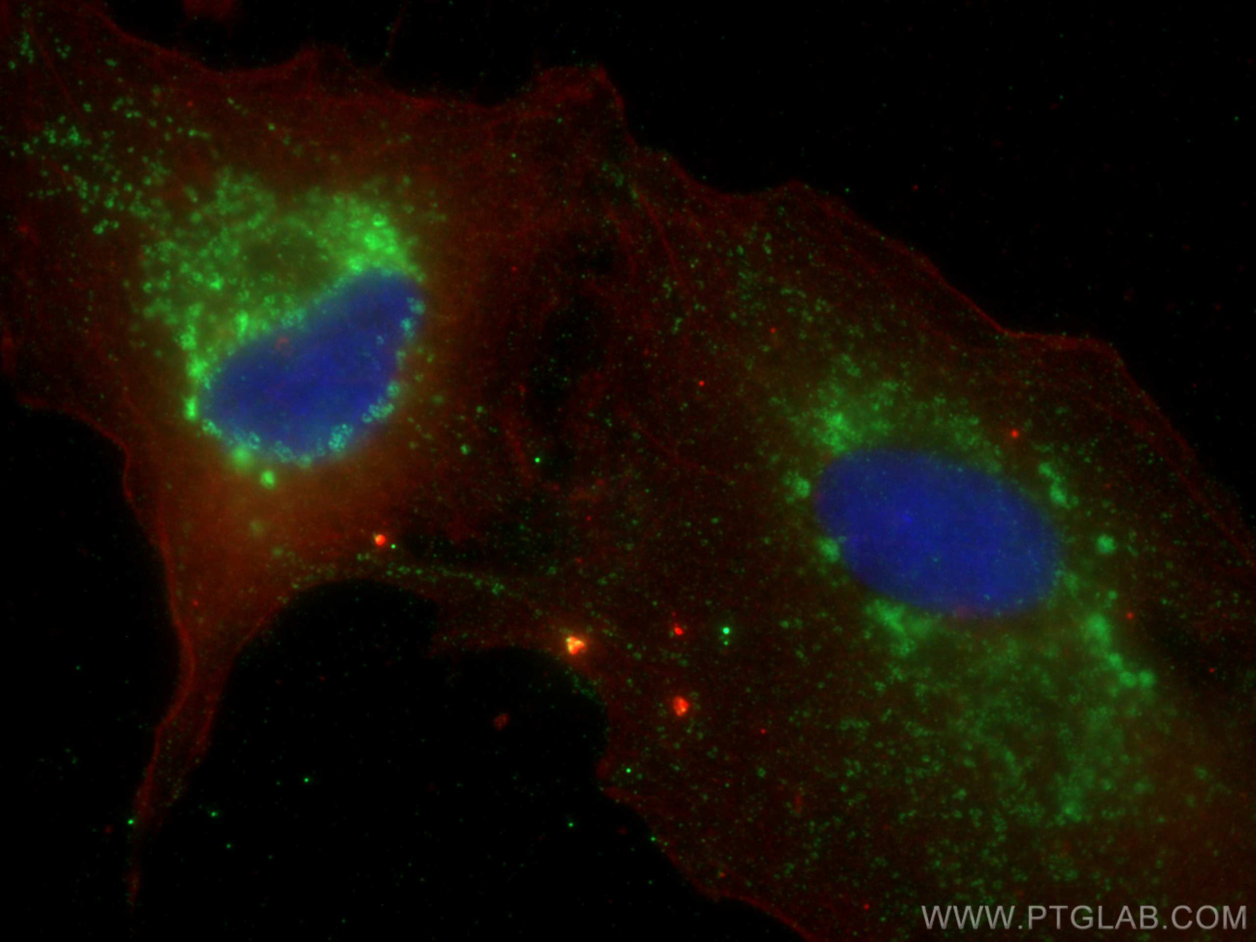 Immunofluorescence (IF) / fluorescent staining of A549 cells using MMP3 Polyclonal antibody (17873-1-AP)