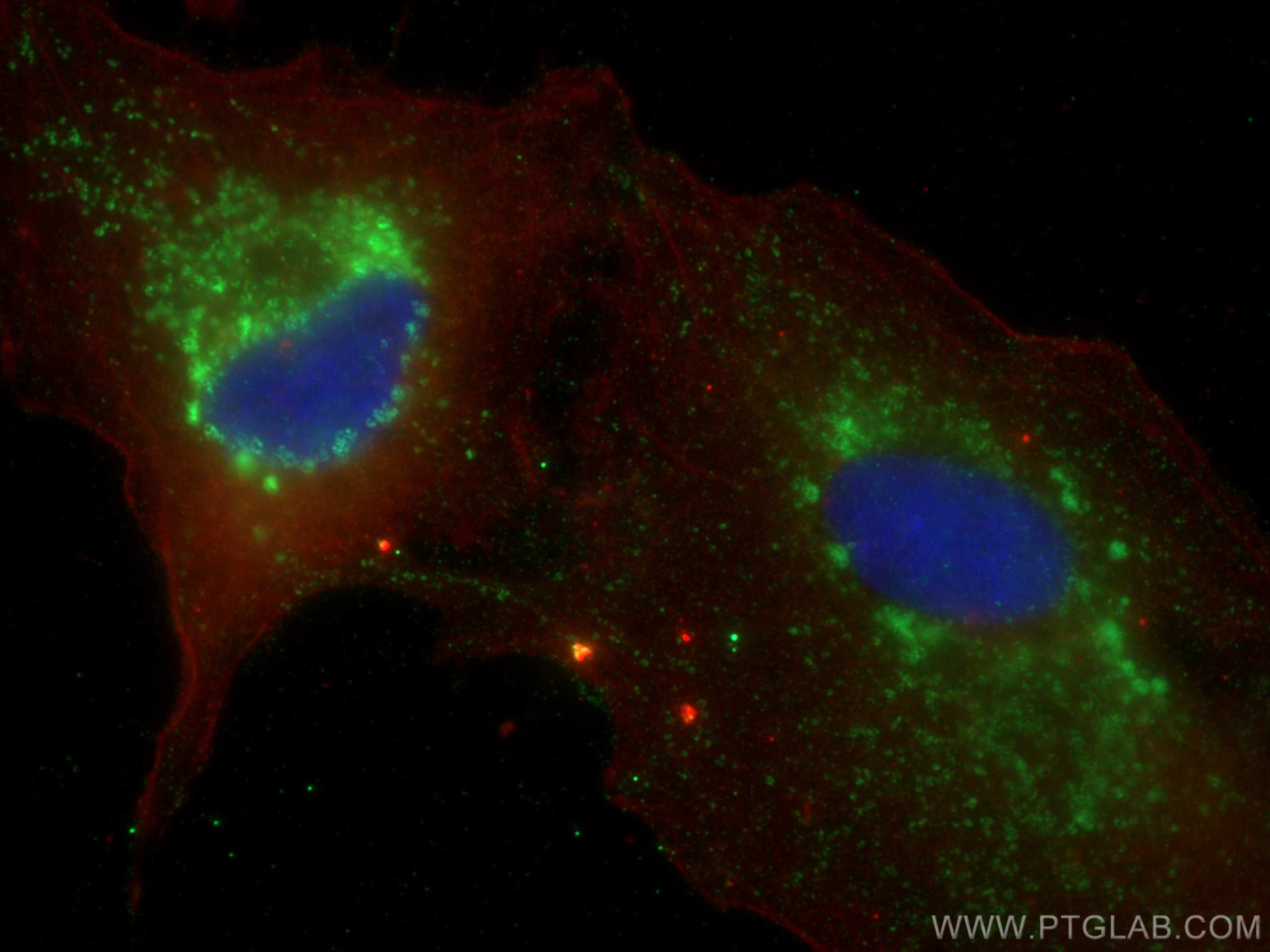 IF Staining of A549 using 17873-1-AP