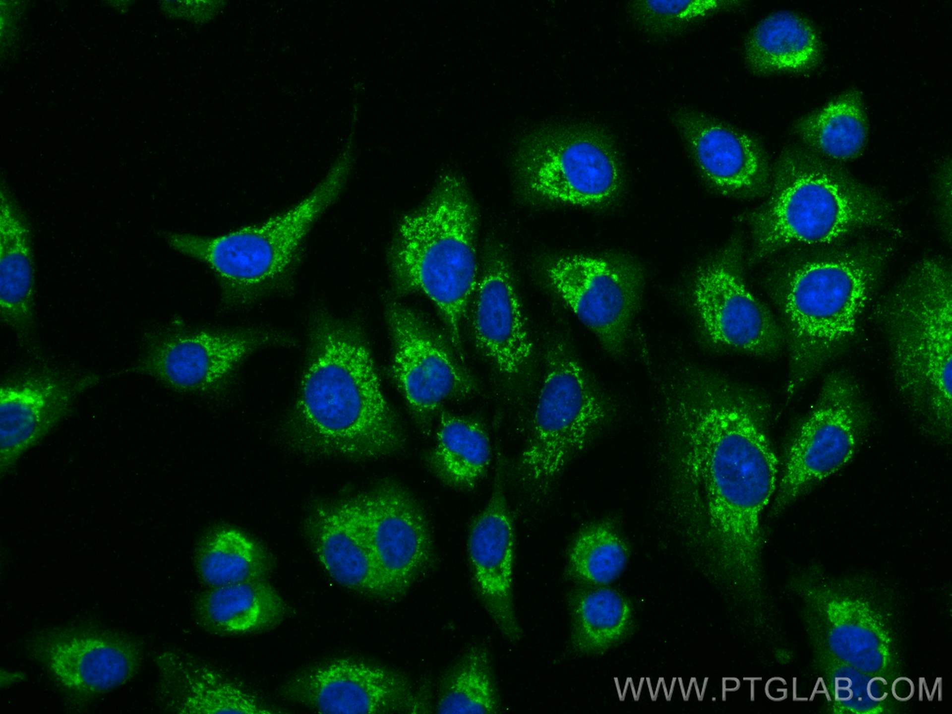 Immunofluorescence (IF) / fluorescent staining of A549 cells using MMP3 Polyclonal antibody (17873-1-AP)