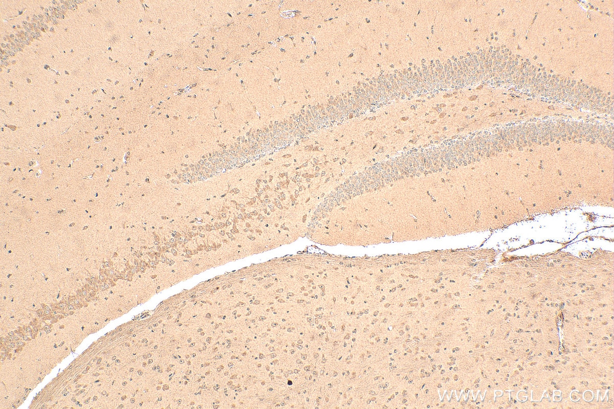 Immunohistochemical analysis of paraffin-embedded mouse brain tissue slide using 17873-1-AP (MMP3 antibody) at dilution of 1:200 (under 10x lens). Heat mediated antigen retrieval with Tris-EDTA buffer (pH 9.0). Immunohistochemistry (IHC) staining of mouse brain tissue using MMP3 Polyclonal antibody (17873-1-AP)