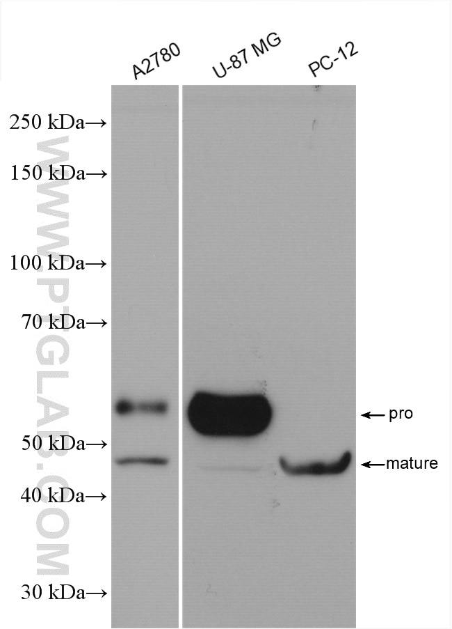 Western Blot (WB) analysis of various lysates using MMP3 Polyclonal antibody (17873-1-AP)