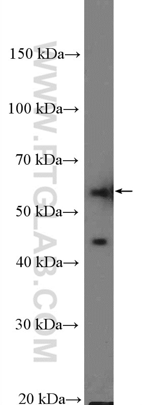 Western Blot (WB) analysis of HeLa cells using MMP3 Polyclonal antibody (17873-1-AP)