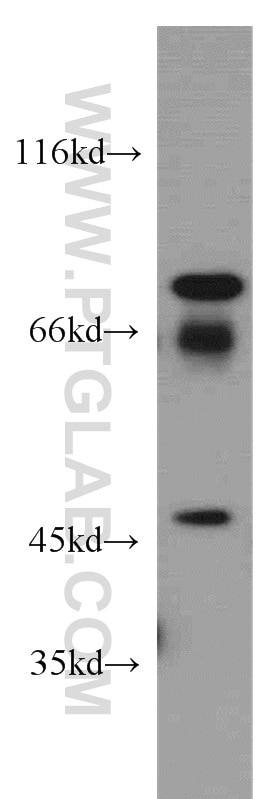 Western Blot (WB) analysis of HeLa cells using MMP3 Polyclonal antibody (17873-1-AP)