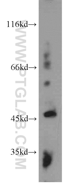 Western Blot (WB) analysis of human skeletal muscle tissue using MMP3 Polyclonal antibody (17873-1-AP)