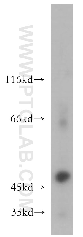Western Blot (WB) analysis of A549 cells using MMP3 Polyclonal antibody (17873-1-AP)