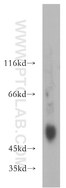 Western Blot (WB) analysis of A2780 cells using MMP3 Polyclonal antibody (17873-1-AP)