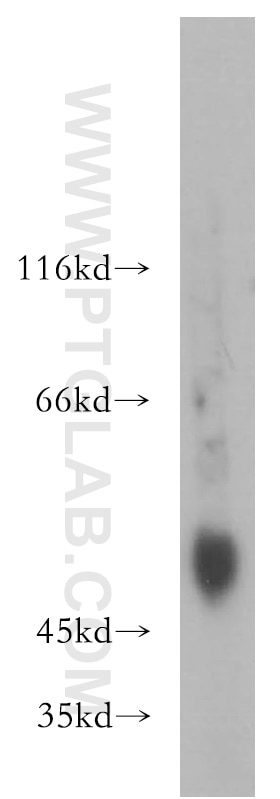 WB analysis of A2780 using 17873-1-AP