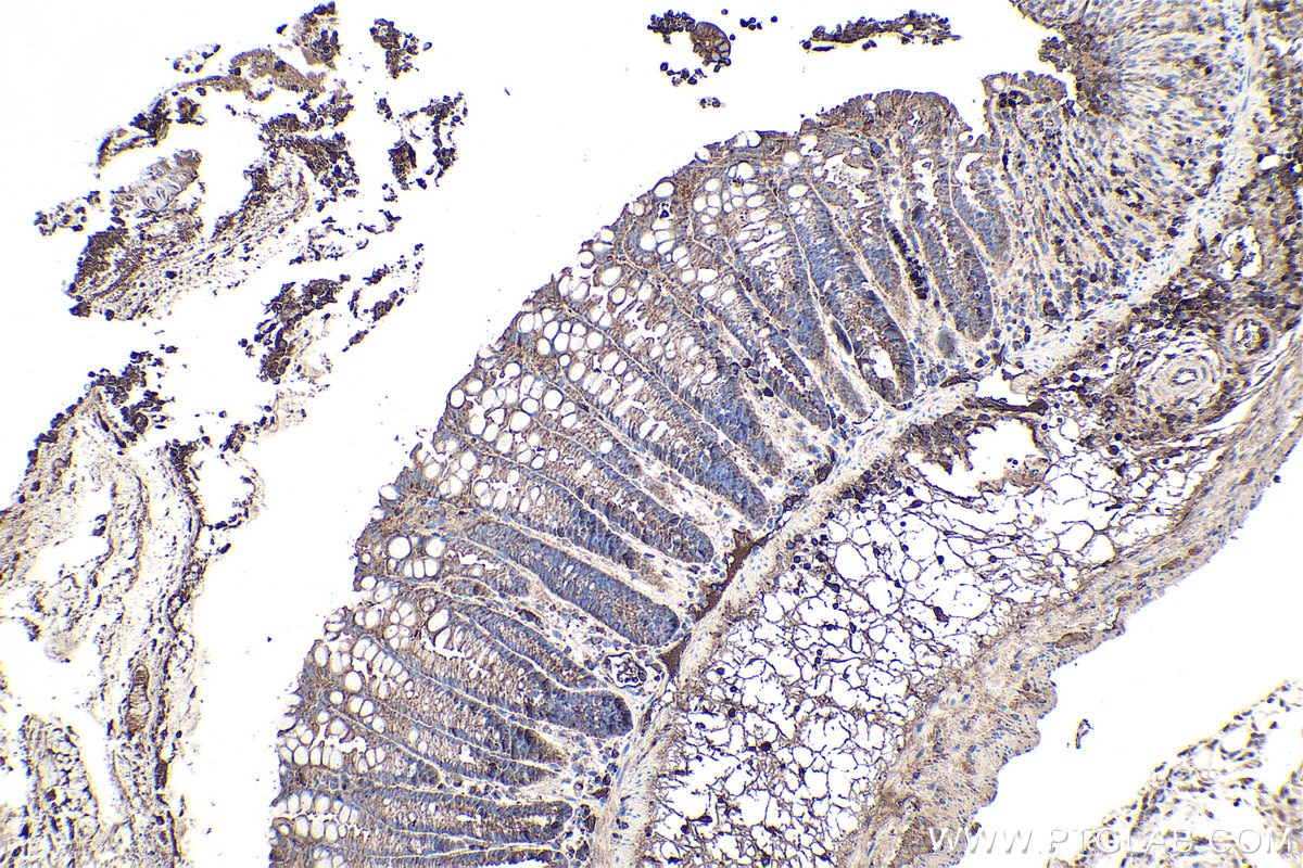 IHC staining of mouse colon using 66338-1-Ig