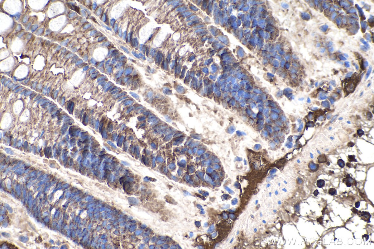 Immunohistochemistry (IHC) staining of mouse colon tissue using MMP3 Monoclonal antibody (66338-1-Ig)