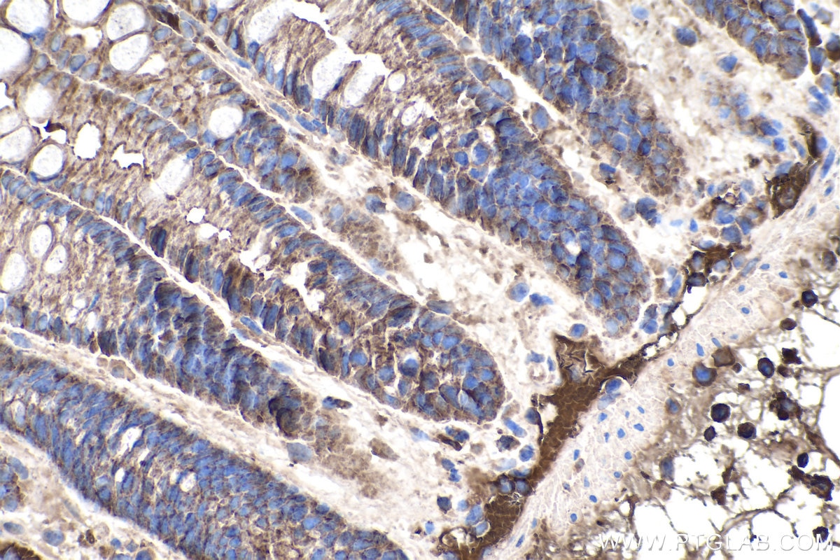 IHC staining of mouse colon using 66338-1-Ig