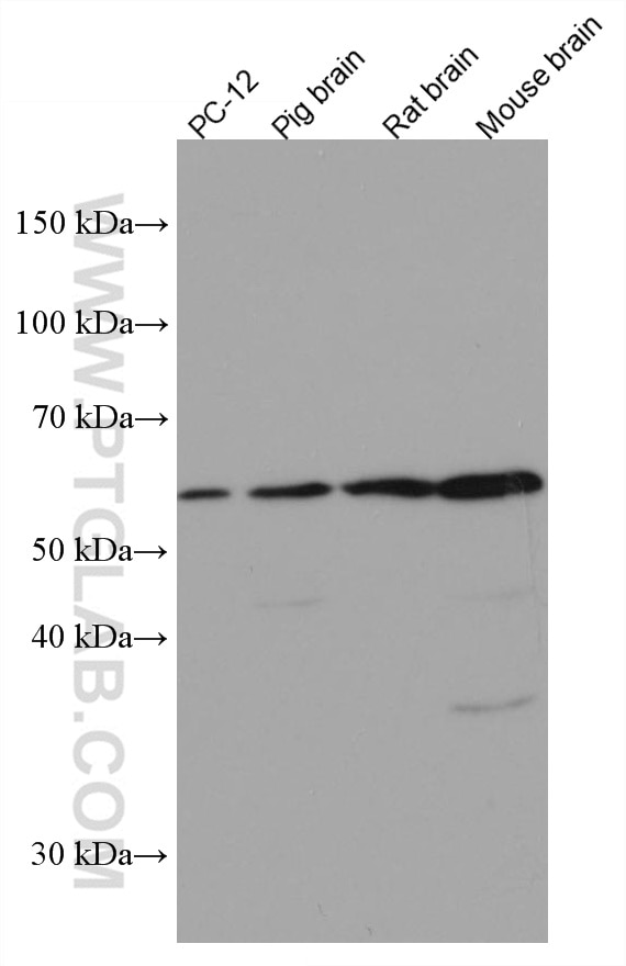 Western Blot (WB) analysis of various lysates using MMP3 Monoclonal antibody (66338-1-Ig)