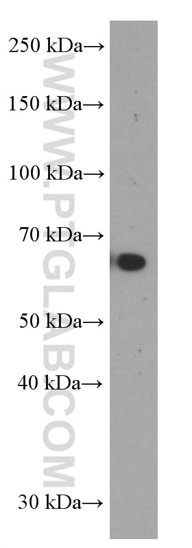 Western Blot (WB) analysis of COLO 320 cells using MMP3 Monoclonal antibody (66338-1-Ig)