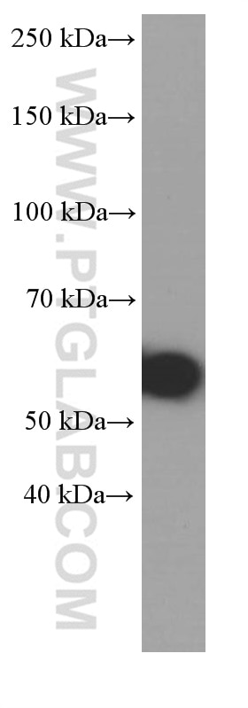 Western Blot (WB) analysis of fetal human brain tissue using MMP3 Monoclonal antibody (66338-1-Ig)