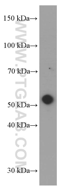 Western Blot (WB) analysis of pig heart tissue using MMP3 Monoclonal antibody (66338-1-Ig)