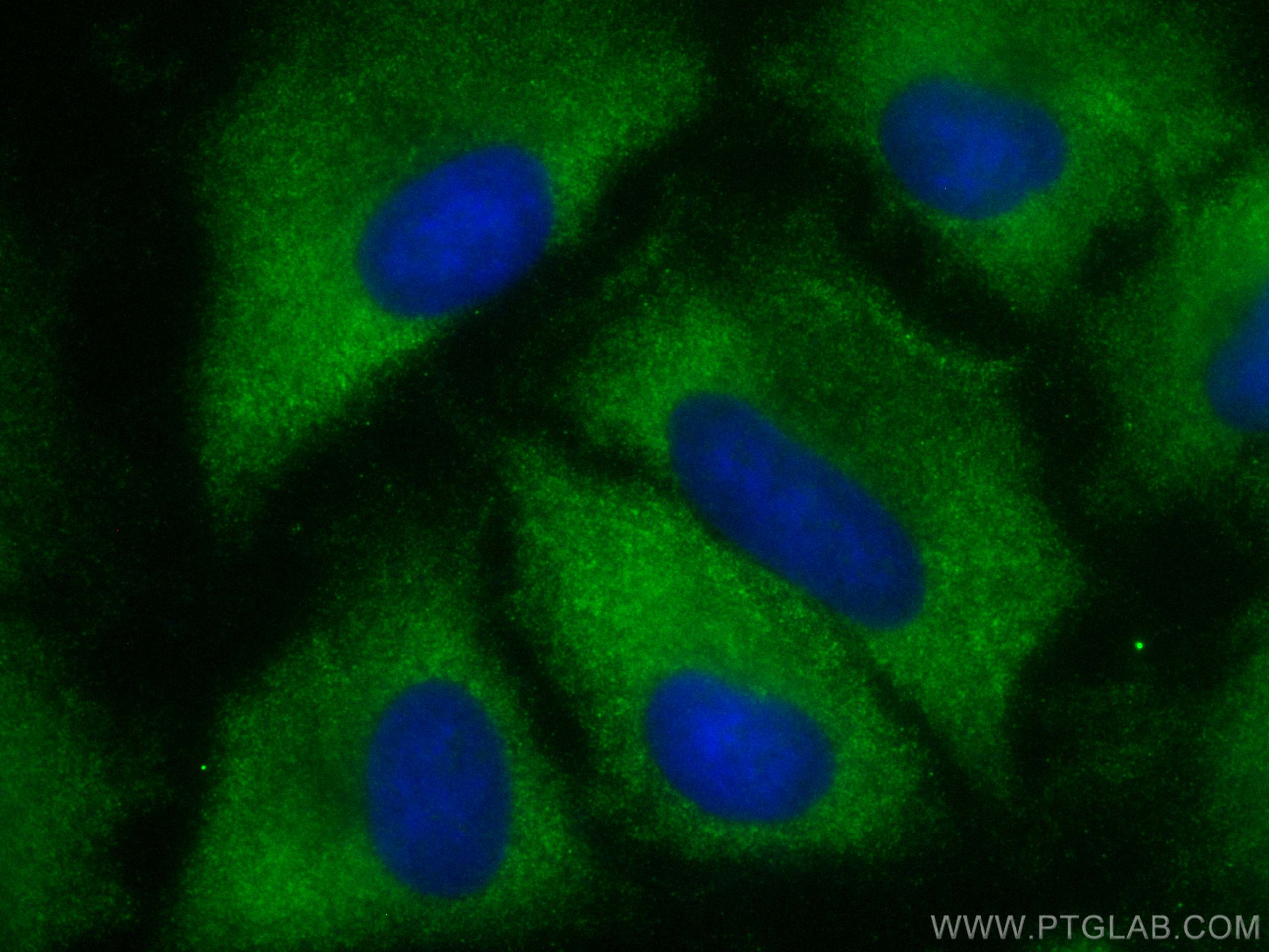 Immunofluorescence (IF) / fluorescent staining of A549 cells using CoraLite® Plus 488-conjugated MMP3 Polyclonal anti (CL488-17873)