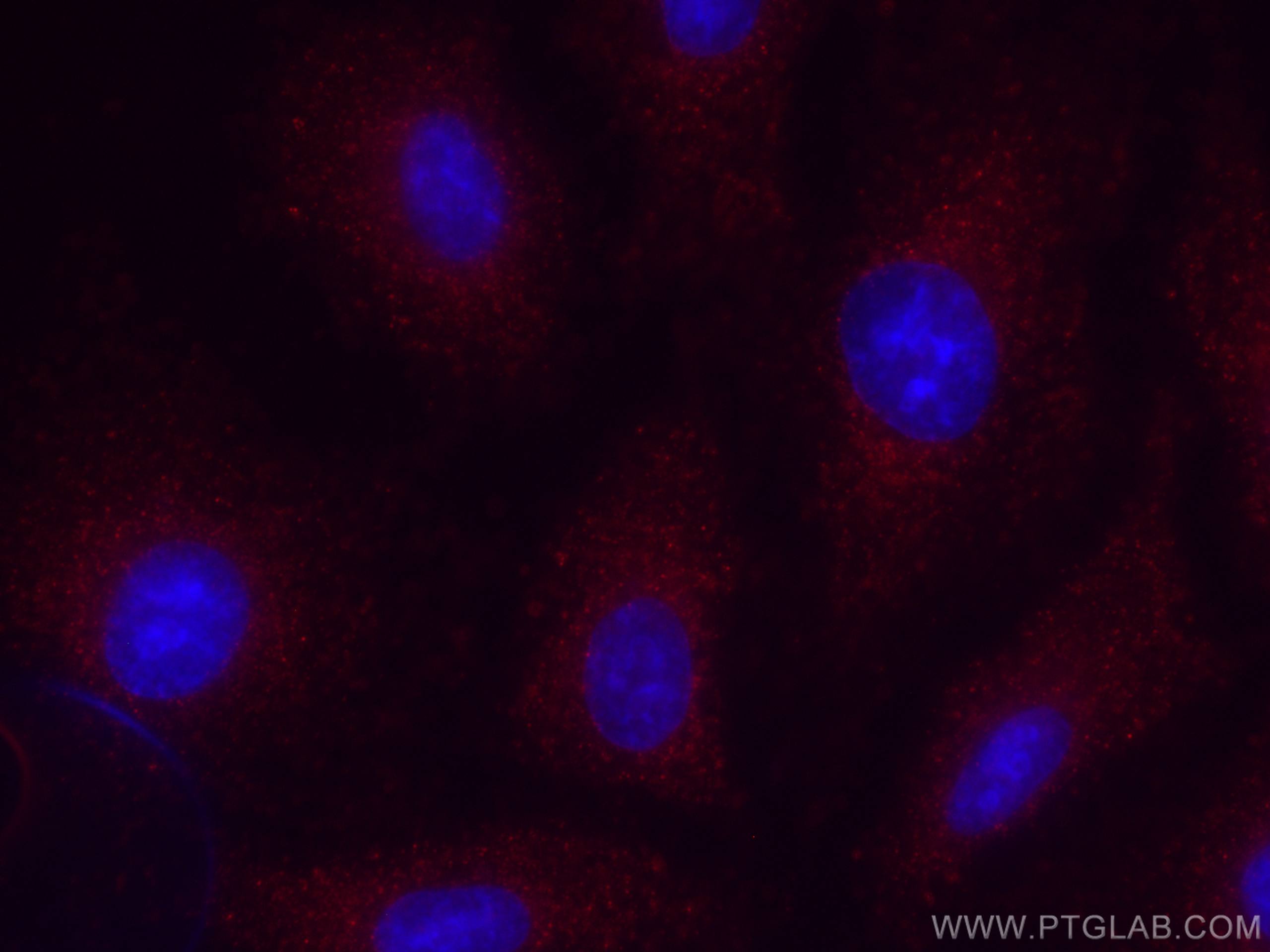 Immunofluorescence (IF) / fluorescent staining of A549 cells using CoraLite®594-conjugated MMP3 Monoclonal antibody (CL594-66338)