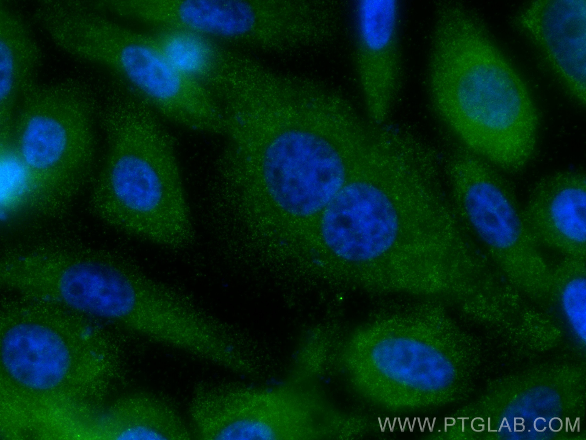 Immunofluorescence (IF) / fluorescent staining of PC-3 cells using MMP7 Polyclonal antibody (10374-2-AP)